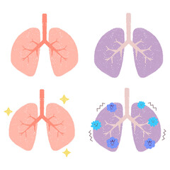 健康な肺と不健康な肺のセットイラスト　PNG