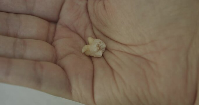 Close Up Rack Focus of a Molar Tooth in a Man's Hand