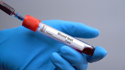 Syringe Filling tube with blood test. Doctor applying blood into the tube