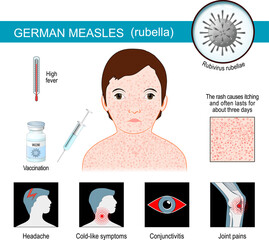 German measles. infographics about symptoms of Rubella