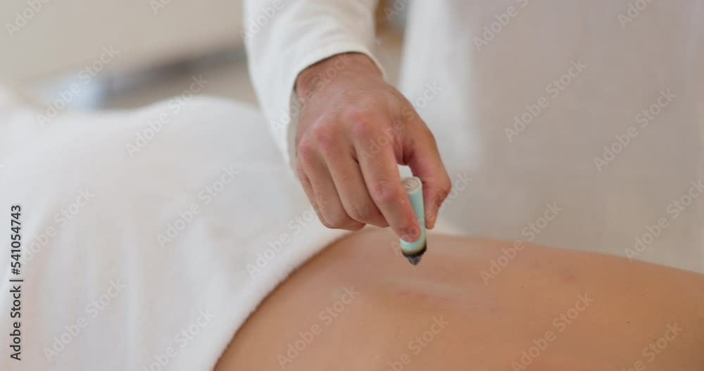 Sticker Wellness, medicine and heat acupuncture on back of female client on spa bed with therapist for moxibustion or moxa smoke therapy. Spiritual healing, body and stress relief with Chinese treatment