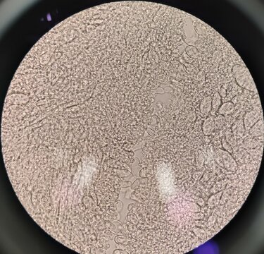 Real fungi basidiospore of Shiitake Mushroom or Lentinula edodes under microscope