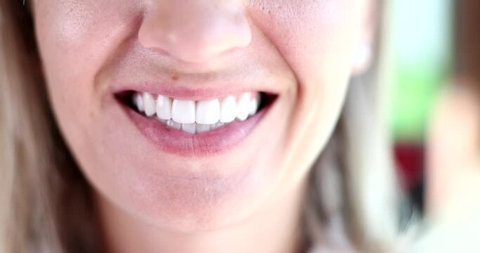 Beautiful snow-white smile of young woman closeup 4k movie slow motion