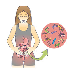 Gastroenteritis as gastrointestinal tract inflammation outline diagram. Educational scheme with bacterial stomach and intestine infection vector illustration. Medical virus caused diarrhea or vomiting - obrazy, fototapety, plakaty
