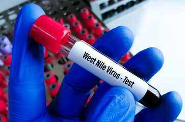 Blood sample for West Nile virus test. 