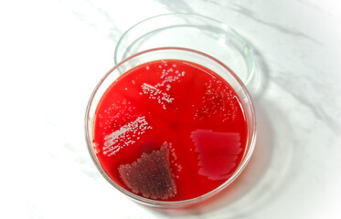Petri dish isolated with Bacterial colony on blood agar meidum. Microbial culture. white background.