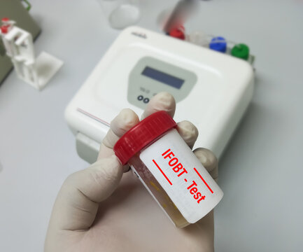 Immunofecal occult blood test (IFOBT). Doctor holding sample container with feces or stool for occult blood test (OBT) to diagnosis of colon cancer.