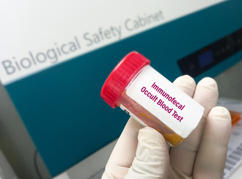 Sample container with stool sample for Immunofecal occult blood test (IFOBT), to diagnosis of colon cancer.