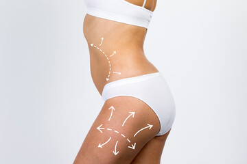Cellulite removal on body girl. Young woman with beautiful and healthy body concept close up, sideways.