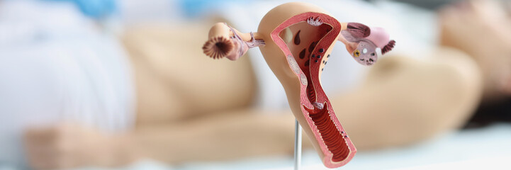 Anatomical model of womans uterus and ovaries, woman on ultrasound scanning