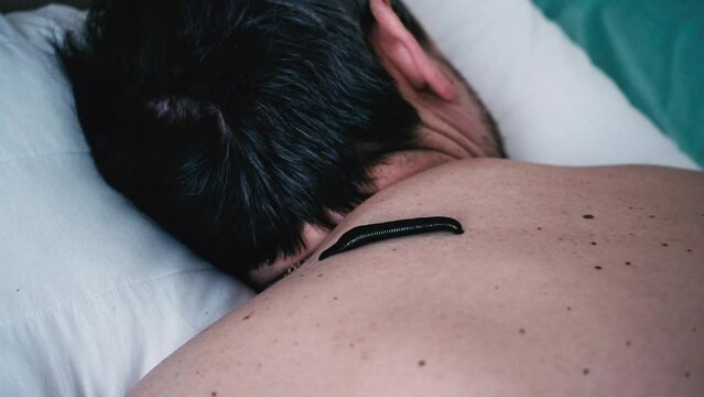 A leech sucks blood on the back of a patient in a hirudotherapy salon 