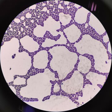 Real staphylococcus gram positive cocci shape bacteria under microscope