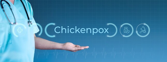 Chickenpox (varicella). Doctor stretches out hand. Interface with text and icons. Medicine digital