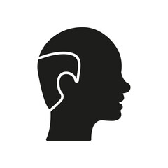 Hairless Male Silhouette Icon. Bald Man Black Pictogram. Hair Loss, Alopecia Medical Problem Icon. Isolated Vector Illustration