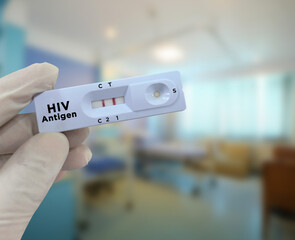 Doctor hold HIV antigen positive test result rapid test cassette. HIV positive - obrazy, fototapety, plakaty
