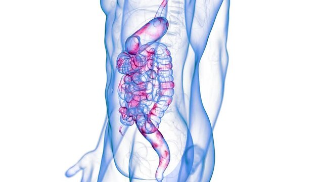 3d rendered medical animation of crohns disease