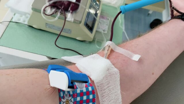 The hand of a man who donates blood. Male donor gives blood in a mobile blood donation center. Blood samples