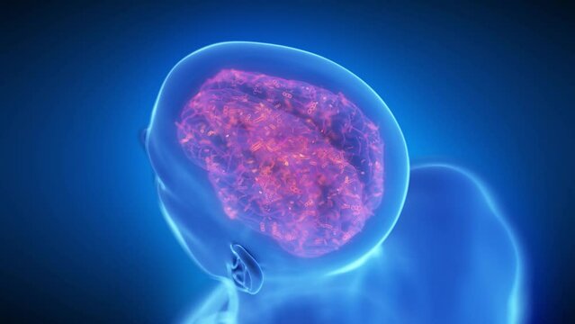 3d rendered medical animation of an infected human brain