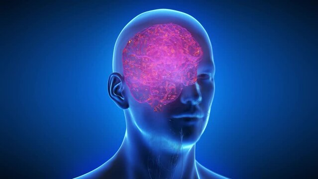 3d rendered medical animation of an infected human brain