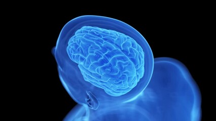 3d rendered medical animation of a degenerating brain