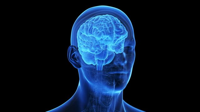 3d rendered medical animation of a degenerating brain