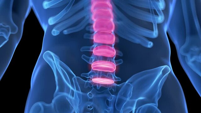 3d rendered medical animation of intervertebral disks