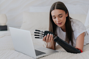 Brunette Italian girl with disability  in white t-shirt connecting artificial palm with limb hand...