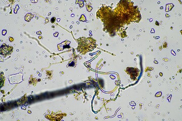 soil microorganisms, with soil fungi hyphae growing in the compost in a farm