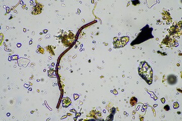 microorganisms and soil biology, with nematodes and fungi under the microscope. in a soil and...