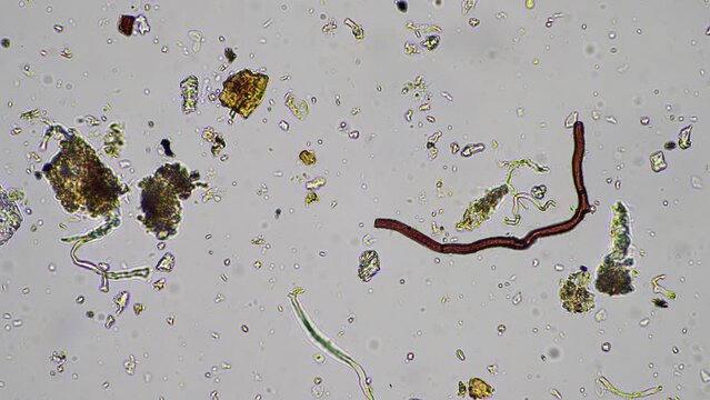 Fungal and fungi hyphae under the microscope in the soil and compost, in a soil biology and microorganism test in Australia.