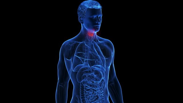 3d rendered medical animation of an inflamed larynx