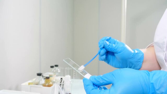Biological testing carried out. gynecologist examining patient with swab for analysis. Doctor rubbing cotton stick with patient specimen sample on it at special glass. biochemist puts bacterial sample