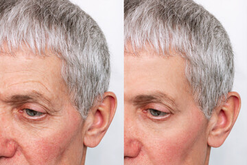 Cropped shot of a elderly caucasian man's face with facial wrinckles on the forehead and near the...