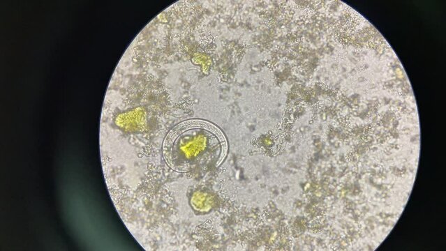 strongyloides stercoralis larva in stool exam finding with microscope 40X.