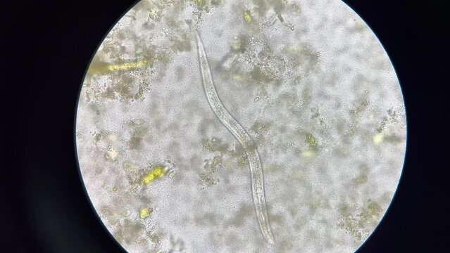 strongyloides stercoralis larva in stool exam finding with microscope 40X.