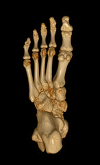 3D rendering  of the foot bones for diagnosis bone fracture and rheumatoid arthritis.