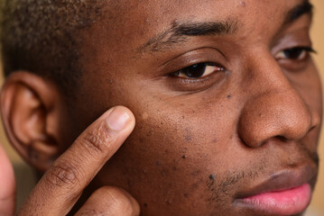 Obraz premium Young handsome African man checking his skin, his hand touching face. Close-up shot on a studio background.