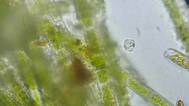 Bell shaped ciliate Vorticella contracts with impressive speed while attached to aquatic vegetation