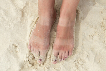 Funny tanned legs on the white sand beach. Women's feet with uneven tan. The concept of skin...