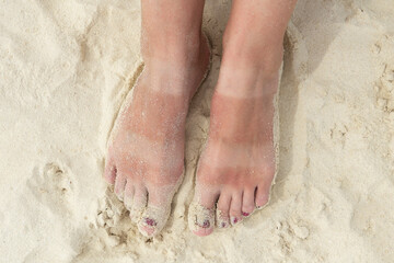 Funny tanned legs on the white sand beach. Women's feet with uneven tan. The concept of skin protection from the sun.
