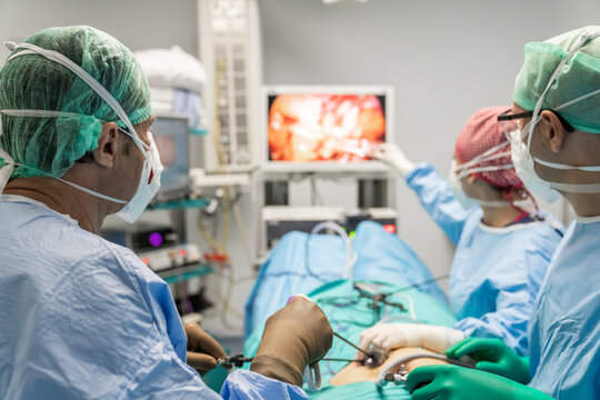The surgeon's holing the instrument in abdomen of patient. The surgeon's doing laparoscopic surgery in the operating room. Minimally invasive surgery. uterus removal with surgical laparoscopy