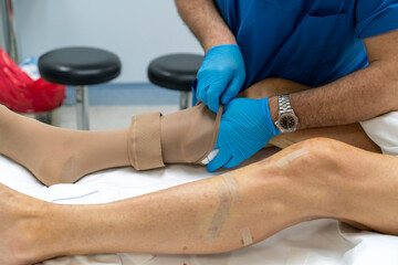 Obraz premium to put on stockings for varicose veins or embolism after varicose surgery in the operating room