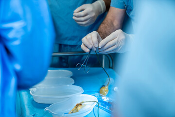 penis penile implant, penis enlargement surgery, balloon insertion inflation, penile prosthesis