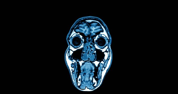 Medical Scan Showing Human Body Part While Scanning