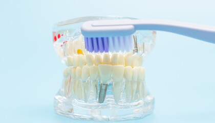 Fototapeta na wymiar Dentist dental prosthetic teeth, gums, roots close-up. Studying dental diseases concept