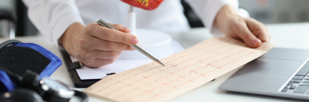 Doctor cardiologist examines electrocardiogram of patient heart in cardiology