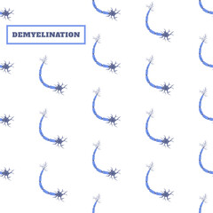 Naklejka premium Demyelination. Neuron myelin sheath damage due to inflammation. Demyelinating disease awareness pattern. Nervous system disorder. Human body anatomy concept. Medical vector illustration.