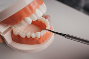 Doctor holds orthodontic model of teeth and dental tool in his office, dental care. Close-up