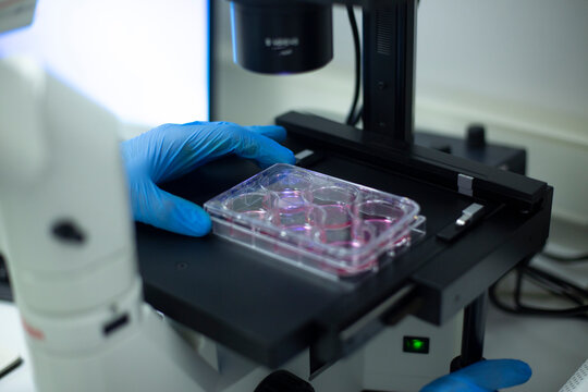 fluorescence microscope at the cell culture laboratory