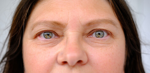 close up part of female face, eyes and forehead of middle-aged woman, small wrinkles on eyelids,...